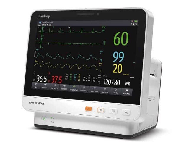 生体情報モニタ